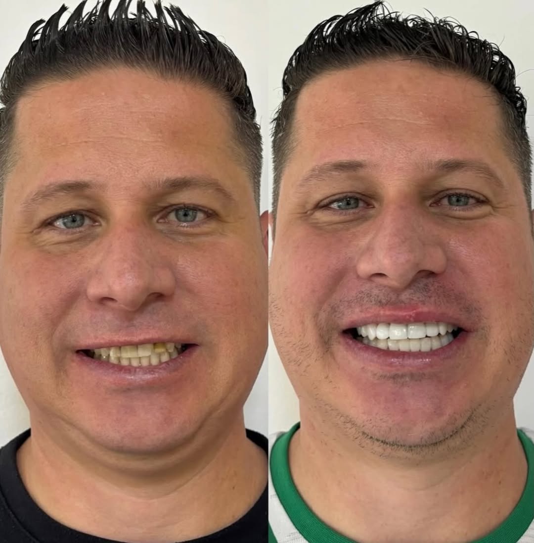 Reabilitação Funcional — antes e depois